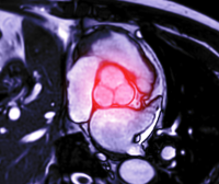 Estudio revela desigualdad en mortalidad y advierte sobre factores de riesgo en menores de 50 años.